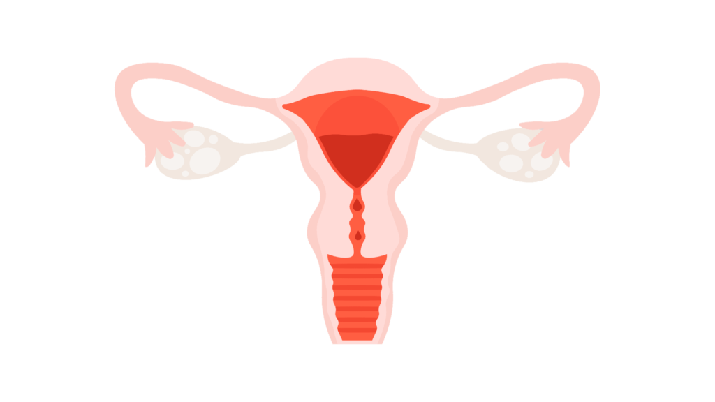 Histeroscopia em Juiz de Fora | Dra Nathalia Mezzonato